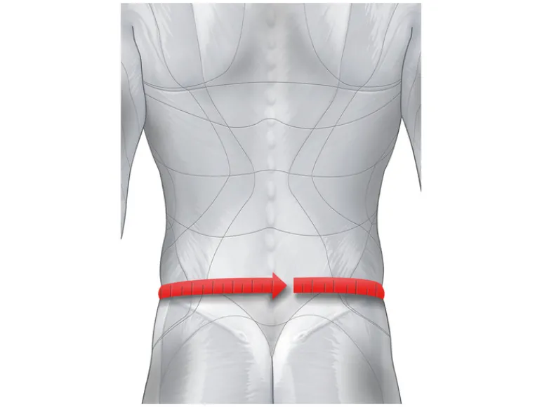 Rugbrace<sensiplast® Sale