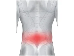 Rugbrace<sensiplast® Sale